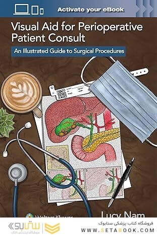 Visual Aid for Perioperative Patient Consult: An Illustrated Guide to Surgical Procedures