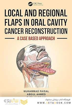 Local and Regional Flaps in Oral Cavity Cancer Reconstruction: A case-based approach 1st Edition