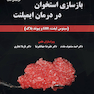 بازسازی استخوان در درمان ایمپلنت