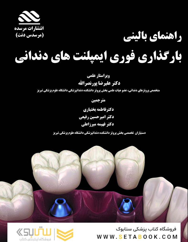 راهنمای بالینی بارگذاری فوری ایمپلنت های دندانی