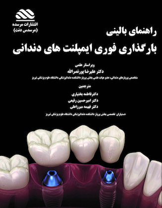 عکس راهنمای بالینی بارگذاری فوری ایمپلنت های دندانی