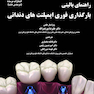 راهنمای بالینی بارگذاری فوری ایمپلنت های دندانی