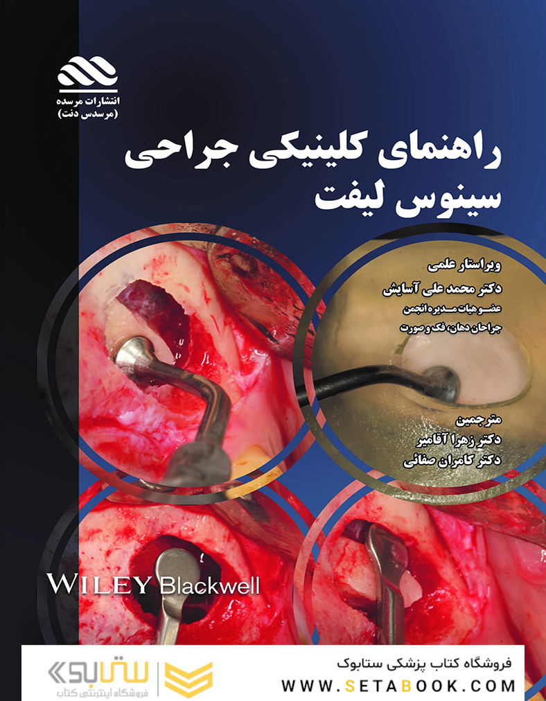 راهنمای کلینیکی جراحی سینوس لیفت