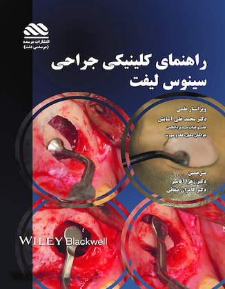 عکس راهنمای کلینیکی جراحی سینوس لیفت