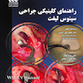 راهنمای کلینیکی جراحی سینوس لیفت