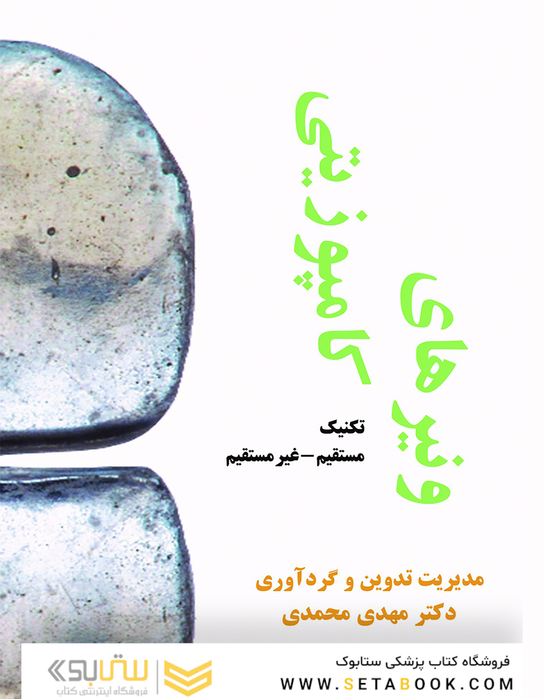ونیرهای کامپوزیتی