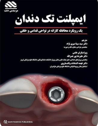 عکس ایمپلنت تک دندان