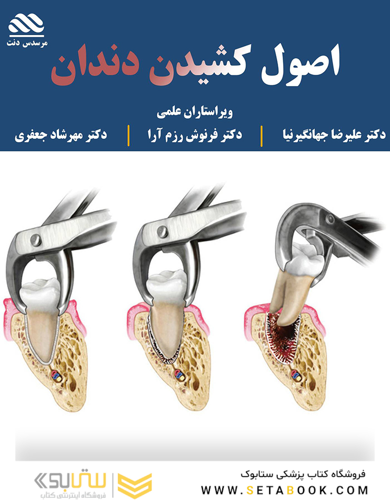 اصول کشیدن دندان