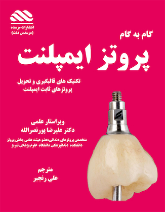 عکس گام به گام پروتزهای ایمپلنت دندان