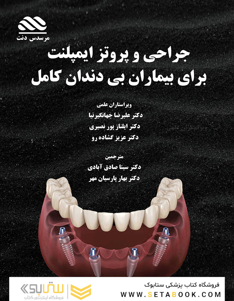 جراحی و پروتز ایمپلنت برای بیماران بی دندان کامل
