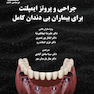 جراحی و پروتز ایمپلنت برای بیماران بی دندان کامل