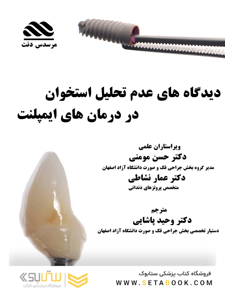 دیدگاه های عدم تحلیل استخوان در درمان های ایمپلنت