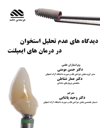 عکس دیدگاه های عدم تحلیل استخوان در درمان های ایمپلنت