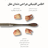 اطلس کلینیکی جراحی دندان عقل