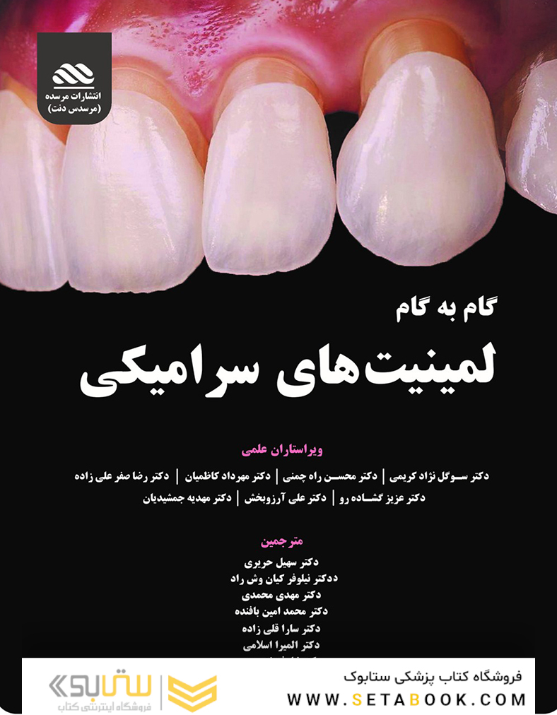 گام به گام لمینیت های سرامیکی همراه با ویدئو آموزشی