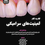گام به گام لمینیت های سرامیکی همراه با ویدئو آموزشی