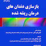 بازسازی دندان های درمان ریشه شده