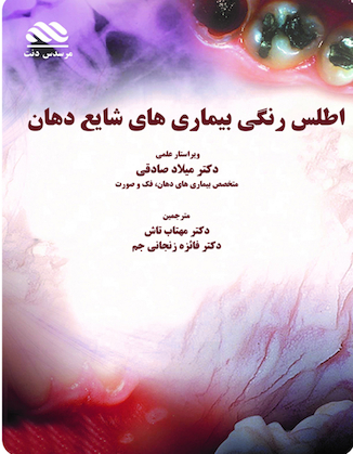 عکس اطلس رنگی بیماری های شایع دهان