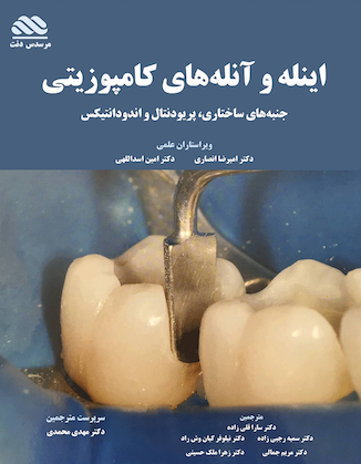 عکس اینله و آنله های کامپوزیتی