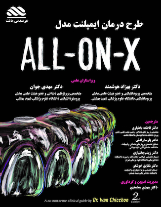 عکس طرح درمان ایمپلنت مدل All-on-x