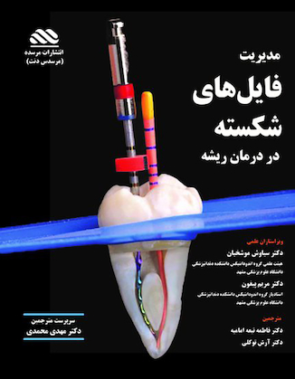 عکس مدیریت فایل های شکسته در درمان ریشه