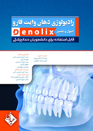 عکس خلاصه تست رادیولوژی دهان وایت فارو اصول و تفسیر denolix