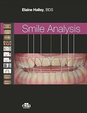 عکس Smile Analysis