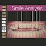 Smile Analysis