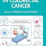 Advancements in Colorectal Cancer 1st Edition