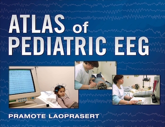 عکس Atlas of Pediatric EEG (Atlas Series) 1st Edition