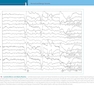 Atlas of Pediatric EEG (Atlas Series) 1st Edition
