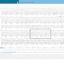 Atlas of Pediatric EEG (Atlas Series) 1st Edition