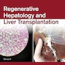 Regenerative Hepatology and Liver Transplantation