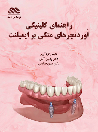 عکس اُوردنچرهای متکی بر ایمپلنت