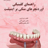 اُوردنچرهای متکی بر ایمپلنت