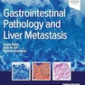 Gastrointestinal Pathology and Liver Metastasis