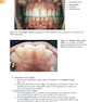 Foundations of Periodontics for the Dental Hygienist