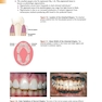 Foundations of Periodontics for the Dental Hygienist