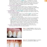 Foundations of Periodontics for the Dental Hygienist