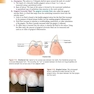 Foundations of Periodontics for the Dental Hygienist