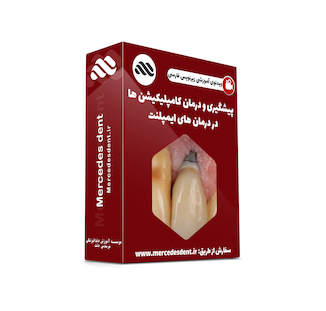 عکس ویدئوی جامع پیشگیری و درمان کامپلیکیشن ها در درمان ایمپلنت