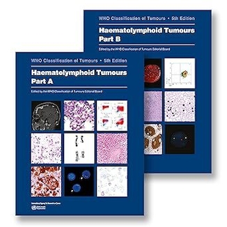 عکس Haematolymphoid Tumours: WHO Classification of Tumours 5th Edition