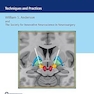 Deep Brain Stimulation: Techniques and Practices 1st Edition