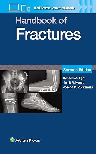 عکس Handbook of Fractures
