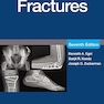 Handbook of Fractures