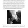 Bone Densitometry in Clinical Practice