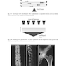 Bone Densitometry in Clinical Practice