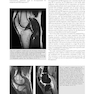 MRI in Orthopaedics and Sports Medicine: The Essentials