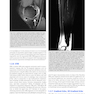 MRI in Orthopaedics and Sports Medicine: The Essentials