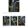 Musculoskeletal Radiology: An Ultimate Guide to Passing the Final FRCR